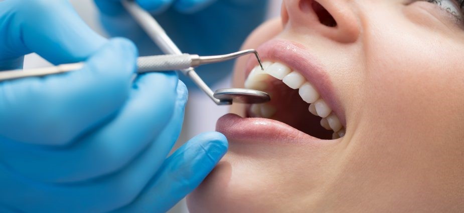 قرار دادن سیلانت های دندانی